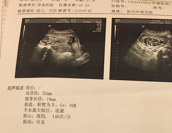  天无绝人之路——供卵一路辛酸我终于拥有自己的宝宝