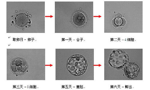 偷食禁果让她不孕不育  供卵试管给予新生希望