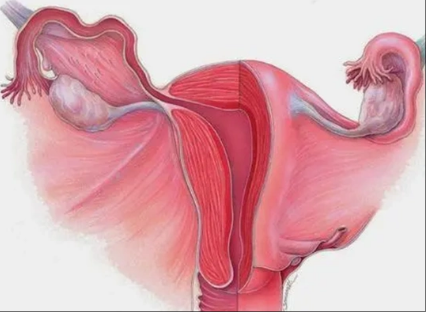 杭州疤痕子宫试管费用全解析：如何选择性价比高的方案？